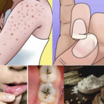 Je viens de trouver ces trucs sur mon lit, ça me fait un peu peur c’est quoi 