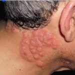 Tout son corps la démangeait… Les médecins découvrent un diagnostic effrayant : allergie ou urticaire ?