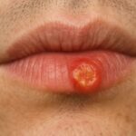 Nous avons attendu dix ans.