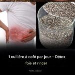 15 symptômes mortels de maladie rénale à détecter précocement