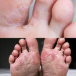 My lips keep peeling and splitting no matter how much lip balm I use. What am I missing?