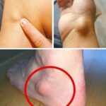 « Jeune femme hospitalisée après avoir eu des rela… Voir plus