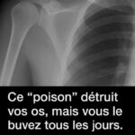 Astuces pour un séchage efficace du linge en période humide