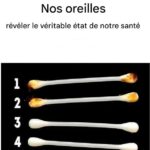 « Jeune femme hospitalisée après avoir eu des rela… Voir plus