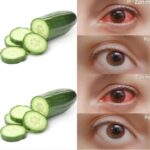 Punaises de lit à la maison : 5 conseils pour s’en débarrasser sans produits toxiques